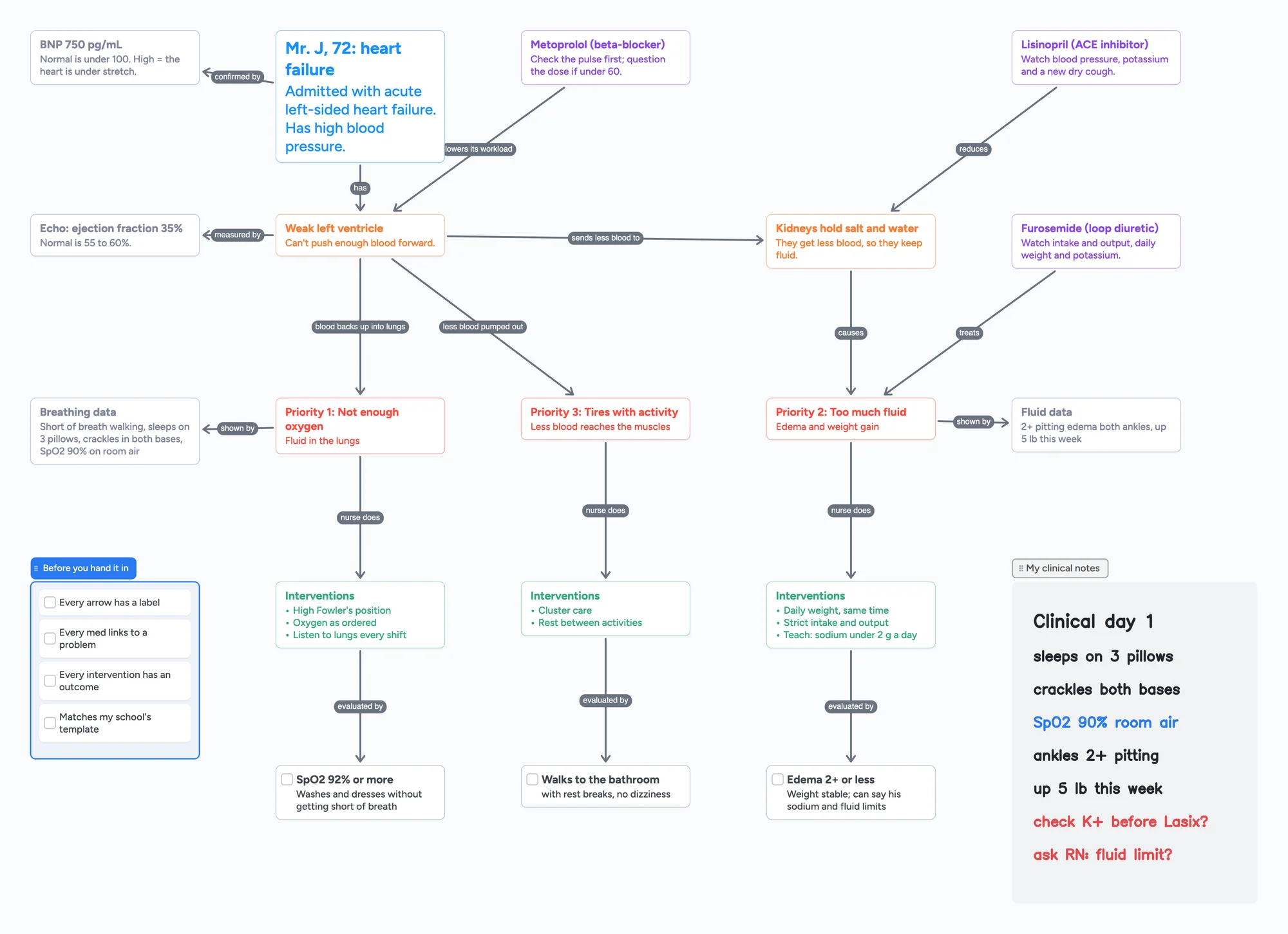 An Instaboard nursing concept map for a heart failure patient: patient card, weak left ventricle, kidneys holding fluid, BNP and echo results, three medications, three priority problems with interventions and outcomes, a hand-in checklist and handwritten clinical notes